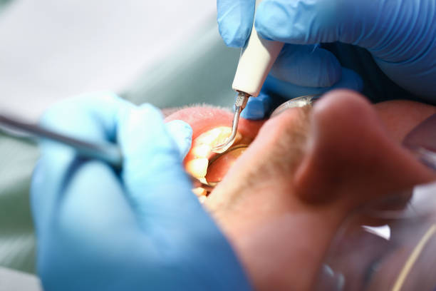 Best Emergency Treatment for Toothache in Fairfield University, CT