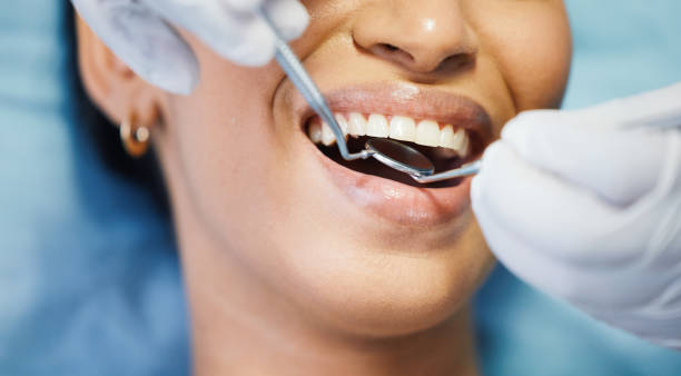 Best Emergency Tooth Extraction in Fairfield University, CT