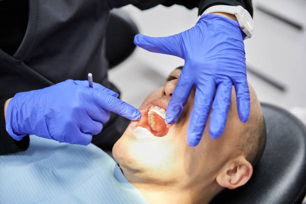 Best Emergency Dental Care for Trauma or Injury in Fairfield University, CT
